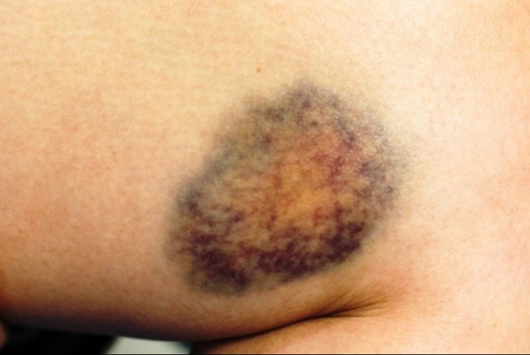 Soha ne szedd be így a C-vitamint! 8 hiba, amit rengetegen elkövetnek