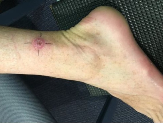 10 leggyakoribb halálok, amibe mindannyian belehalhatunk! Az 5. ok meglepett minket!