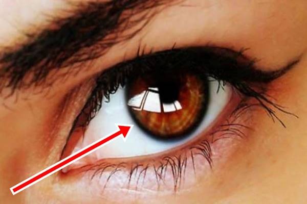 Ez a legnagyobb probléma a barna szemű emberekkel! Te is közéjük tartozol?