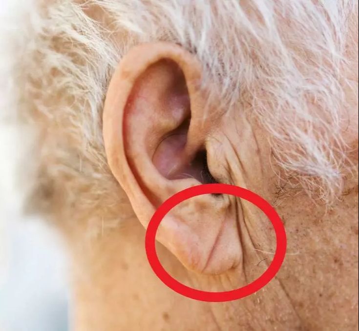 A test figyelmeztető jelei: amikor a fülünkben dobog a szív – egy tünet, amit