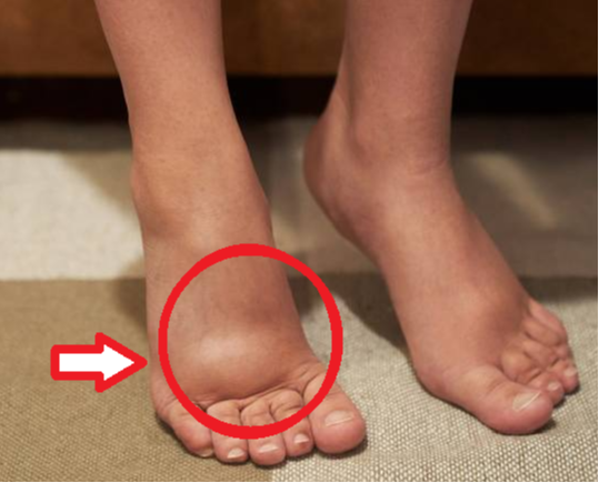 Kiabálja az orvos: Ha ezt a tünetet észleled magadon, azonnal nézesd meg a szíved