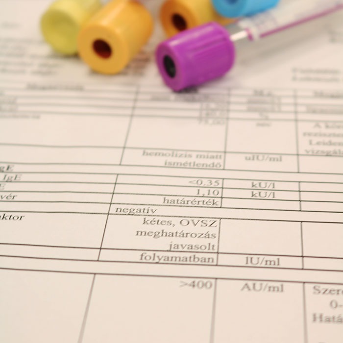 Vedd elő a laboreredményed és ellenőrizd ezt a sort! Ha ezt látod, megtámadta a szervezeted a betegség