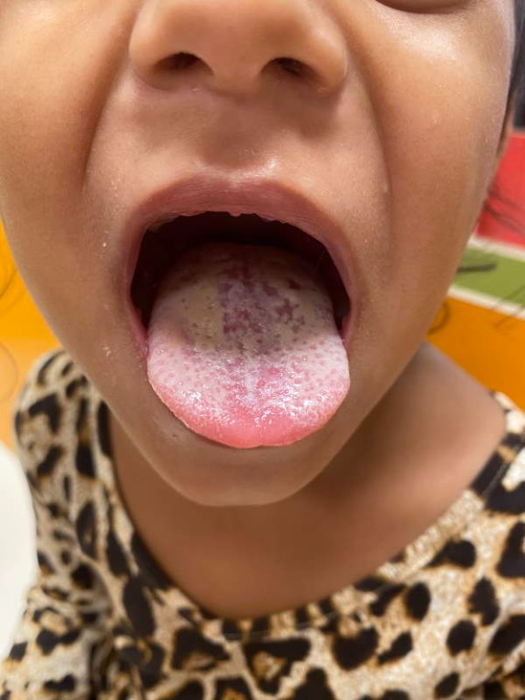 Vérrög van a szervezetedben? Akár halálos is lehet, soha ne hagyd figyelmen kívül ezeket a jeleket!