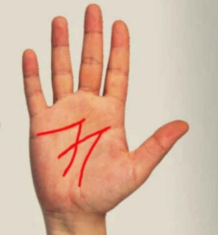 Látsz „M” betűt a kezeden? Ha igen, akkor szerencséd van: a jel jelentése