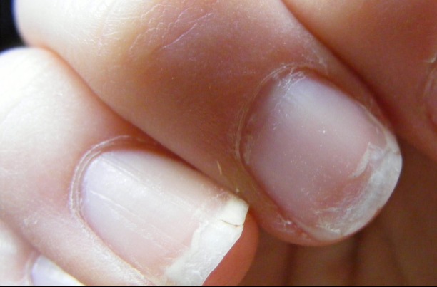 Nézd meg a kezed, és tudd meg, meddig fogsz élni: ezt árulják el a körmeid