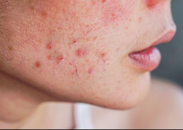 Alvás közben több száz apró parazita mászik az arcodon. Mégpedig fontos oka van: