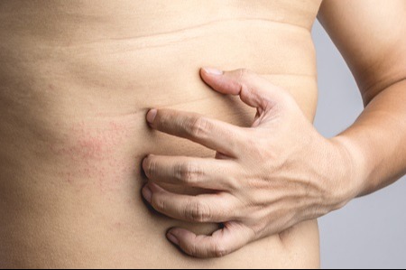 Változókor: az intim területeken is érzékelhető – akár fájdalmas panaszok is jelentkezhetnek